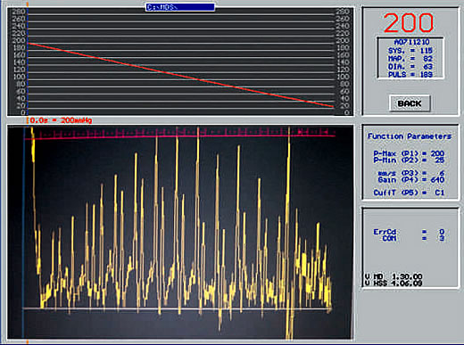 cardiac output visible in oscillometric hight definition measurement