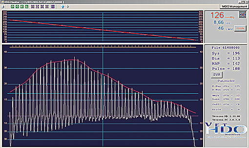 blood pressure curve of a cat with kidney disease and hypertension