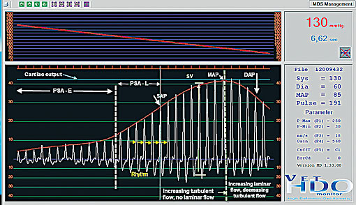 normal arterial opening behavior in healthy cat