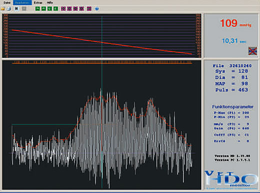 linearity in blood pressure measurement becoming visible with bpm software